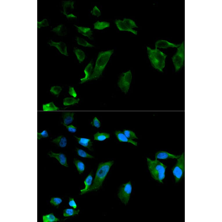 Immunofluorescence - NEK8 Antibody from Signalway Antibody (32109) - Antibodies.com