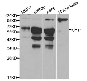 Western blot - SYT1 Antibody from Signalway Antibody (32113) - Antibodies.com