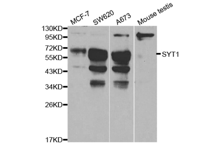 Western blot - SYT1 Antibody from Signalway Antibody (32113) - Antibodies.com
