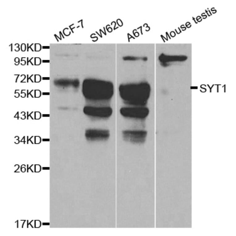 Western blot - SYT1 Antibody from Signalway Antibody (32113) - Antibodies.com
