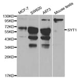 Western blot - SYT1 Antibody from Signalway Antibody (32113) - Antibodies.com