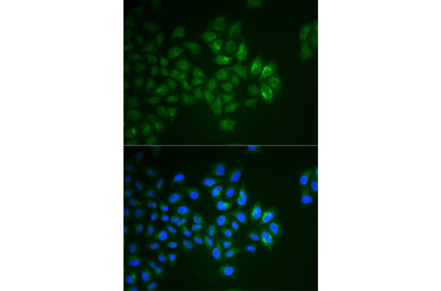 Immunofluorescence - SYT1 Antibody from Signalway Antibody (32113) - Antibodies.com