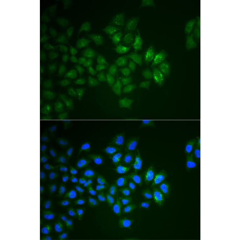 Immunofluorescence - SYT1 Antibody from Signalway Antibody (32113) - Antibodies.com