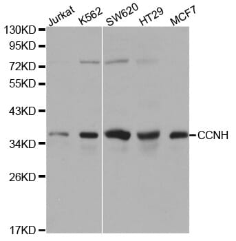 Western blot analysis of extracts of various cell lines, using CCNH antibody.