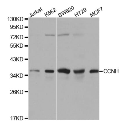 Western blot - CCNH Antibody from Signalway Antibody (32116) - Antibodies.com