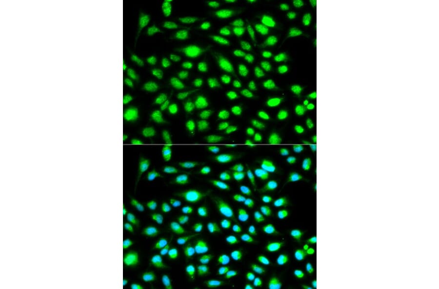 Immunofluorescence - CCNH Antibody from Signalway Antibody (32116) - Antibodies.com