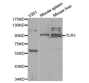 Western blot - TLR1 Antibody from Signalway Antibody (32117) - Antibodies.com