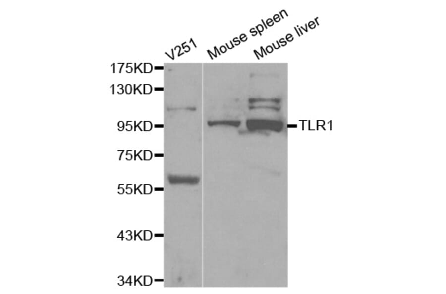 Western blot - TLR1 Antibody from Signalway Antibody (32117) - Antibodies.com