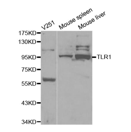 Western blot - TLR1 Antibody from Signalway Antibody (32117) - Antibodies.com