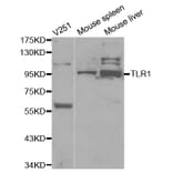 Western blot - TLR1 Antibody from Signalway Antibody (32117) - Antibodies.com
