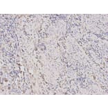 Immunohistochemistry - TLR1 Antibody from Signalway Antibody (32117) - Antibodies.com
