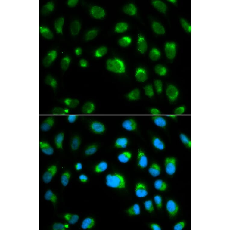 Immunofluorescence - TLR1 Antibody from Signalway Antibody (32117) - Antibodies.com