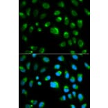 Immunofluorescence - TLR1 Antibody from Signalway Antibody (32117) - Antibodies.com