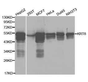 Western blot - KRT8 Antibody from Signalway Antibody (32124) - Antibodies.com