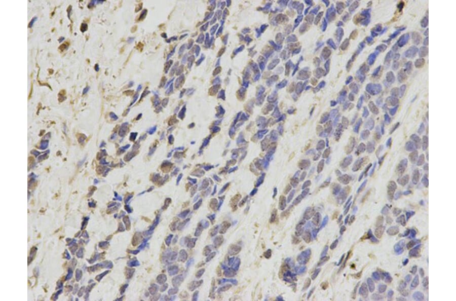 Immunohistochemistry - KRT8 Antibody from Signalway Antibody (32124) - Antibodies.com