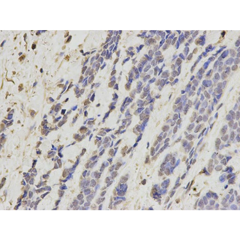 Immunohistochemistry - KRT8 Antibody from Signalway Antibody (32124) - Antibodies.com