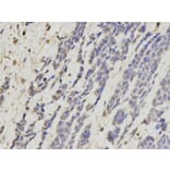 Immunohistochemistry - KRT8 Antibody from Signalway Antibody (32124) - Antibodies.com