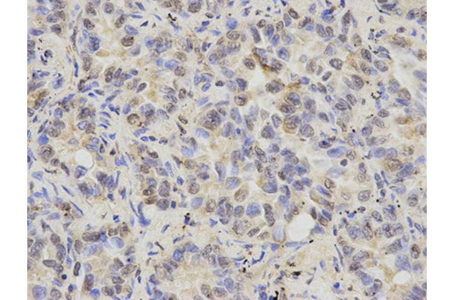 Immunohistochemistry - KRT8 Antibody from Signalway Antibody (32124) - Antibodies.com