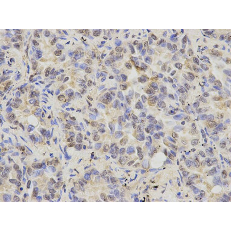 Immunohistochemistry - KRT8 Antibody from Signalway Antibody (32124) - Antibodies.com