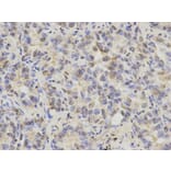 Immunohistochemistry - KRT8 Antibody from Signalway Antibody (32124) - Antibodies.com
