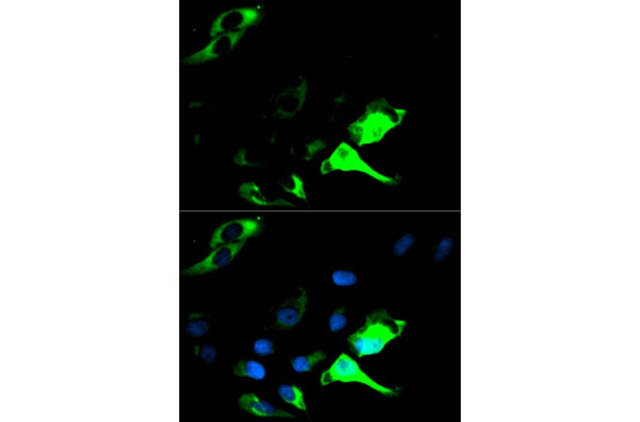 Immunofluorescence - KRT8 Antibody from Signalway Antibody (32124) - Antibodies.com