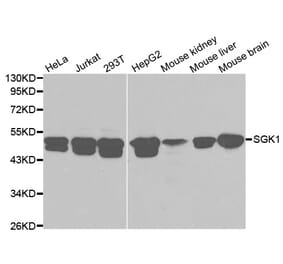 Western blot - SGK1 Antibody from Signalway Antibody (32125) - Antibodies.com