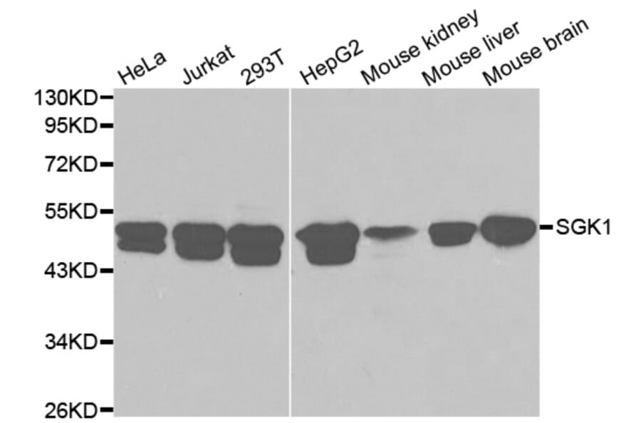 Western blot - SGK1 Antibody from Signalway Antibody (32125) - Antibodies.com