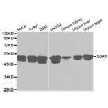 Western blot - SGK1 Antibody from Signalway Antibody (32125) - Antibodies.com