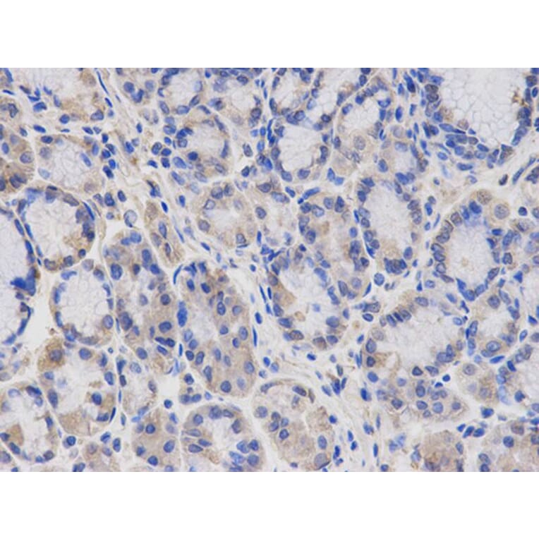 Immunohistochemistry - SGK1 Antibody from Signalway Antibody (32125) - Antibodies.com