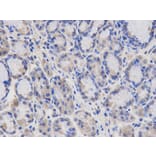 Immunohistochemistry - SGK1 Antibody from Signalway Antibody (32125) - Antibodies.com