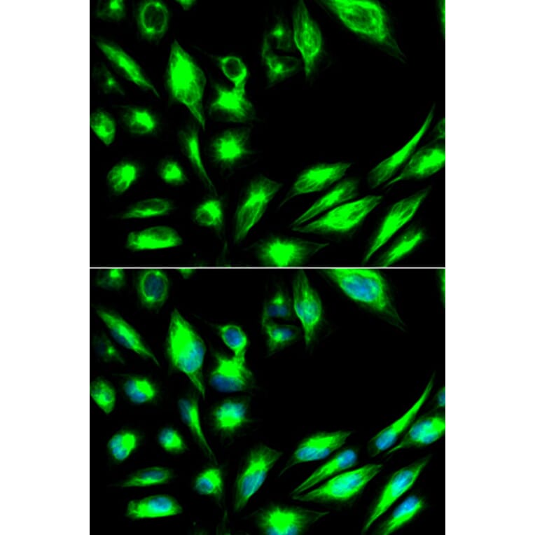 Immunofluorescence - SGK1 Antibody from Signalway Antibody (32125) - Antibodies.com