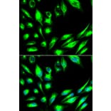 Immunofluorescence - SGK1 Antibody from Signalway Antibody (32125) - Antibodies.com
