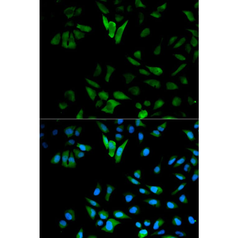 Immunofluorescence - ENO1 Antibody from Signalway Antibody (32128) - Antibodies.com