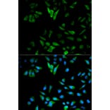Immunofluorescence - ENO1 Antibody from Signalway Antibody (32128) - Antibodies.com