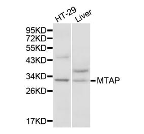 Western blot - MTAP Antibody from Signalway Antibody (32132) - Antibodies.com
