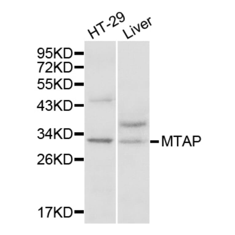 Western blot - MTAP Antibody from Signalway Antibody (32132) - Antibodies.com