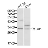 Western blot - MTAP Antibody from Signalway Antibody (32132) - Antibodies.com