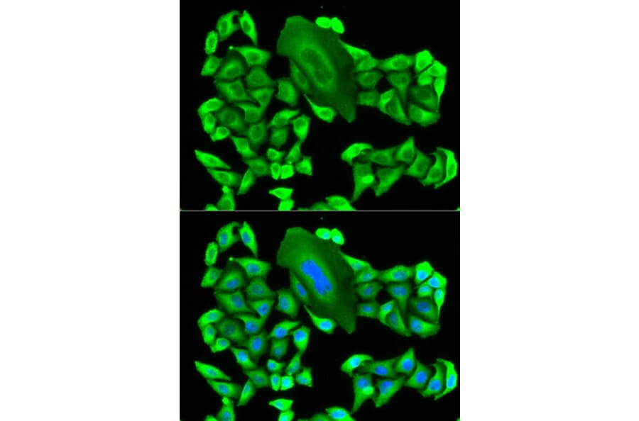 Immunofluorescence - MTAP Antibody from Signalway Antibody (32132) - Antibodies.com