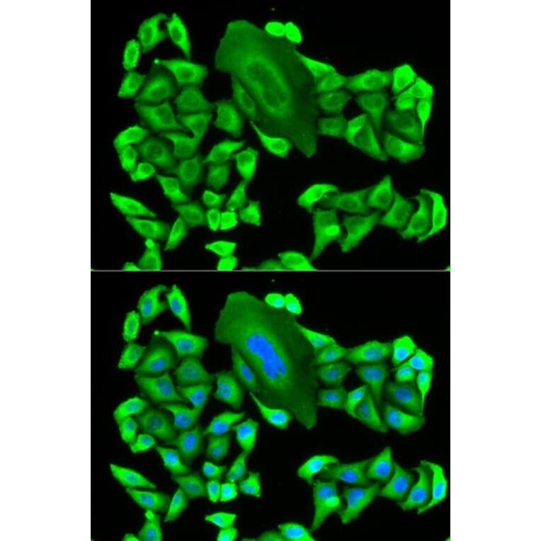 Immunofluorescence - MTAP Antibody from Signalway Antibody (32132) - Antibodies.com