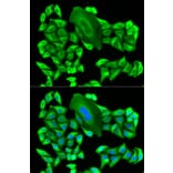Immunofluorescence - MTAP Antibody from Signalway Antibody (32132) - Antibodies.com