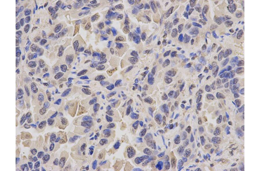Immunohistochemistry - MCM3 Antibody from Signalway Antibody (32137) - Antibodies.com