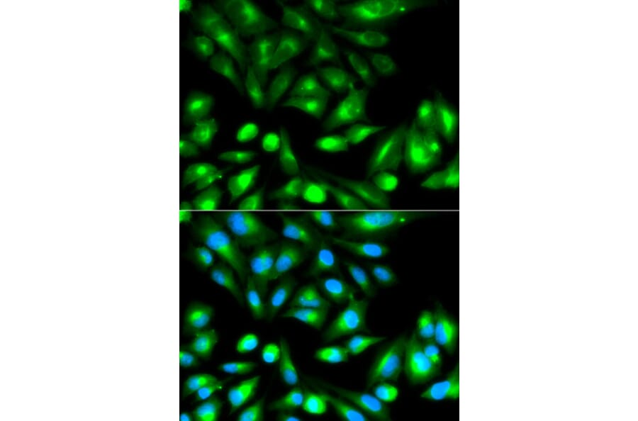 Immunofluorescence - RHOC Antibody from Signalway Antibody (32138) - Antibodies.com