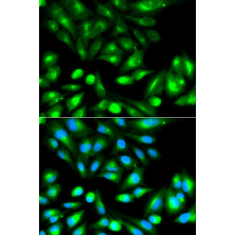 Immunofluorescence - RHOC Antibody from Signalway Antibody (32138) - Antibodies.com