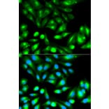 Immunofluorescence - RHOC Antibody from Signalway Antibody (32138) - Antibodies.com