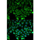Immunofluorescence - CUL3 Antibody from Signalway Antibody (32149) - Antibodies.com