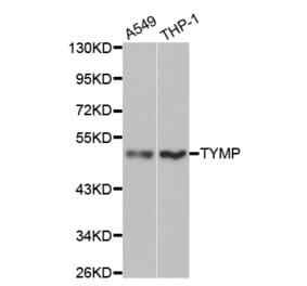 Western blot - TYMP Antibody from Signalway Antibody (32154) - Antibodies.com