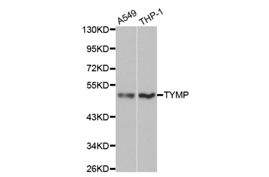 Western blot - TYMP Antibody from Signalway Antibody (32154) - Antibodies.com