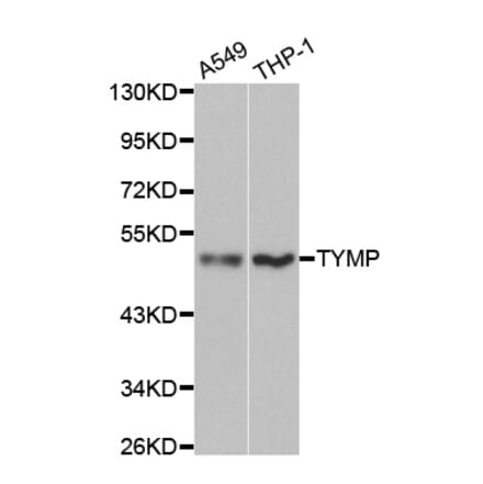 Western blot - TYMP Antibody from Signalway Antibody (32154) - Antibodies.com