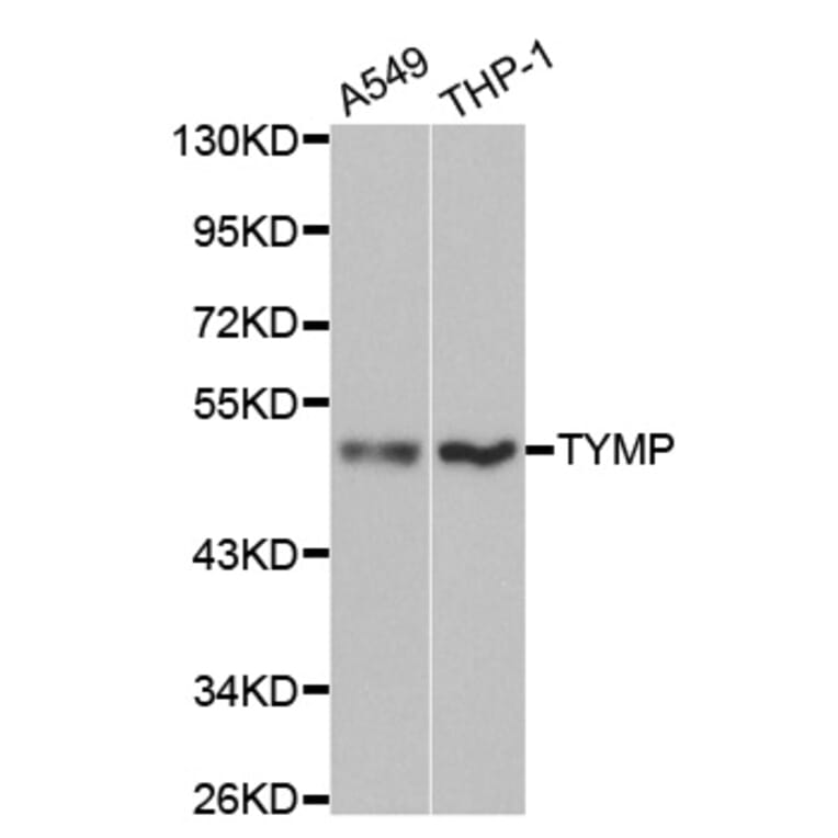 Western blot - TYMP Antibody from Signalway Antibody (32154) - Antibodies.com