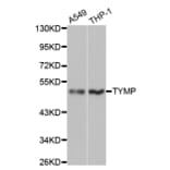 Western blot - TYMP Antibody from Signalway Antibody (32154) - Antibodies.com
